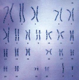 Muestra de cromosomas humanos.